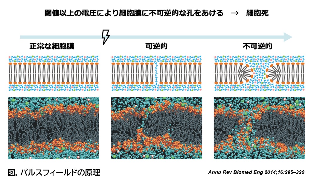 図. パルスフィールドの原理－心房細動に対するパルスフィールドアブレーション（Pulse Field Ablation: PFA）